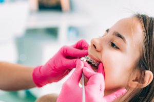 higiene bucal con brackets
