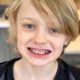 Beneficios de la ortodoncia infantil